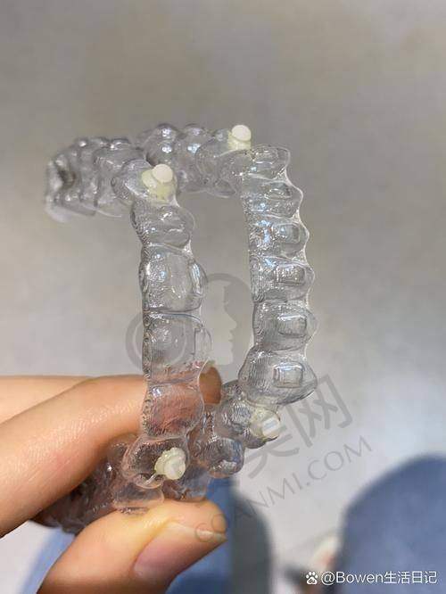 我是如何选择北京中诺口腔进行隐适美隐形矫正的？