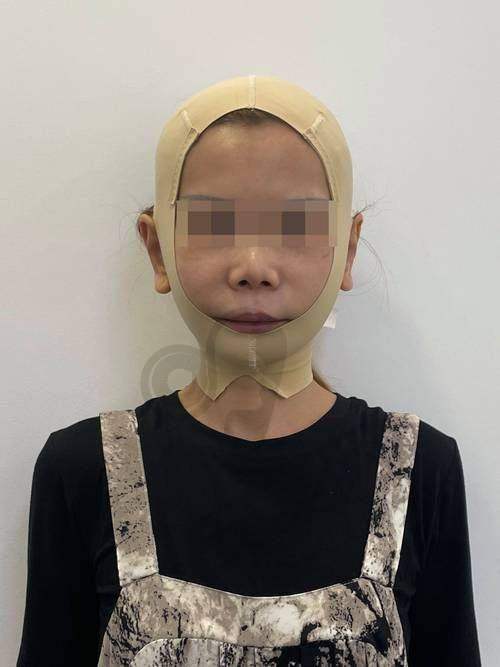 如何选择适合自己的面部提升方案？