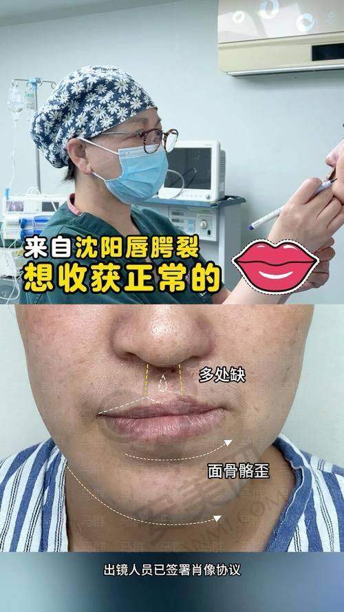 唇裂修复后需要注意哪些事项？