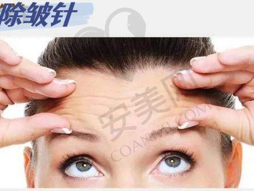 在新疆威兹曼找苏莉医生打除皱针有哪些优势？