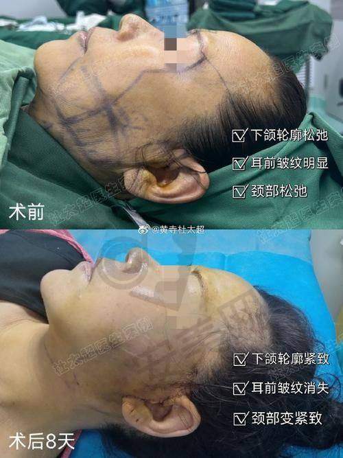 北京黄寺杜太超医生的优势在哪里？