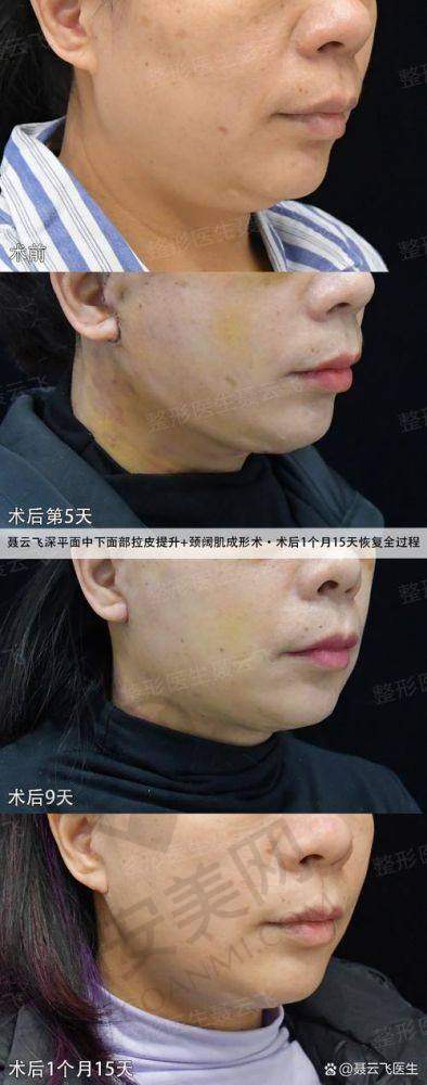 手术的安心性如何保护？