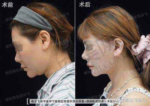 就诊前需要做哪些准备？