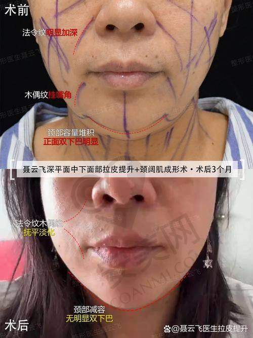谢宏彬怎么联系挂号