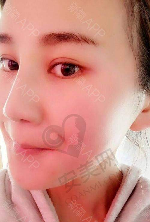 手术过程，会不会特别痛苦？