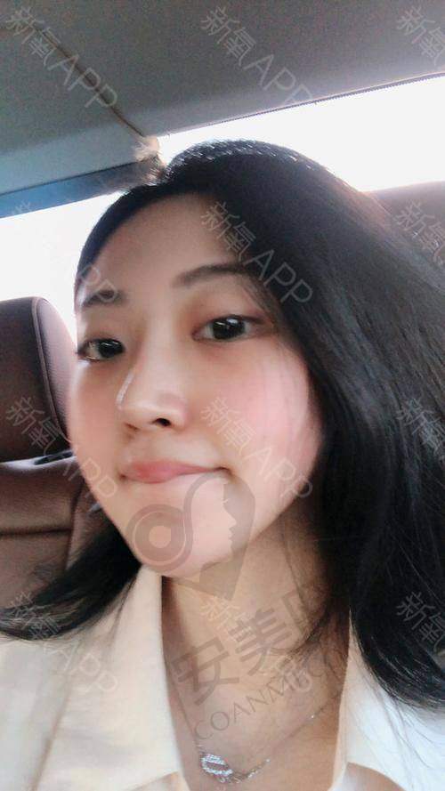 术后修复，需要注意些什么？
