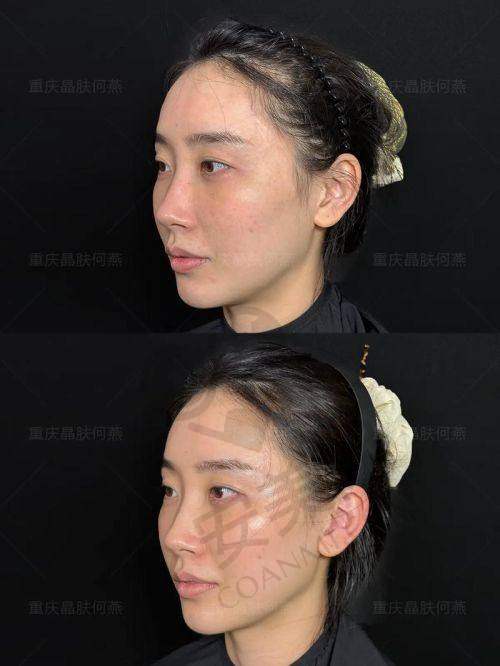 术后修复需要注意什么？