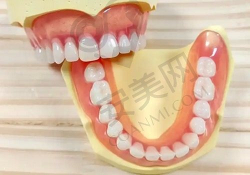 沈阳德立联合口腔医院开展BPS吸附性义齿，12580元起效果好价格优 