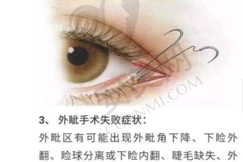 辽宁曙光胸部下垂矫正的成效和口碑如何？