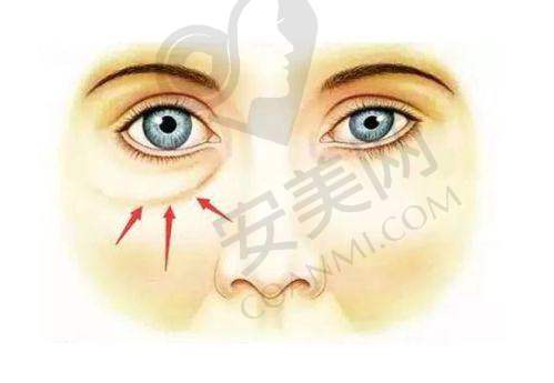 成都银海医美的设备精良吗？