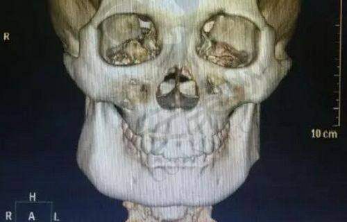 东莞壹加壹整形医院的价格合理吗？