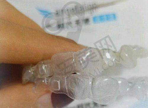 常见问题解答