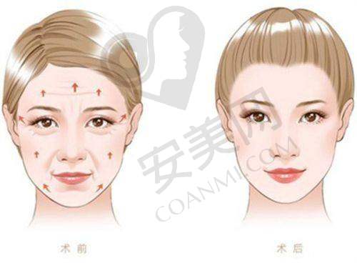 辽宁曙光的服务质量在胸部下垂矫正中有多重要？