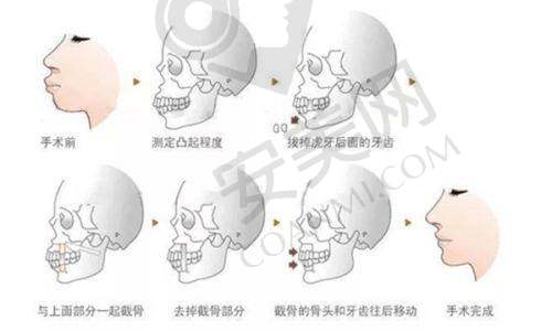 3、重庆星荣刘彦龙医生整形技术怎么样？