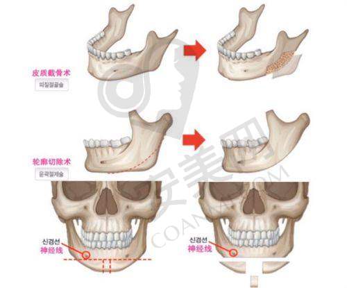 5、铜仁华美陈诚医生患者评价