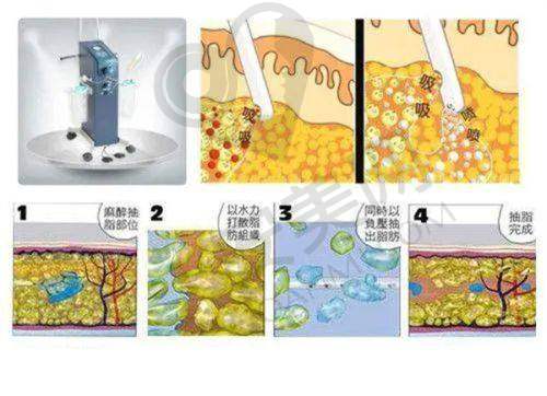 辽宁曙光的医疗设备对胸部下垂矫正有何帮助？