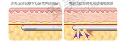 如何进一步了解常州美贝尔的口碑？