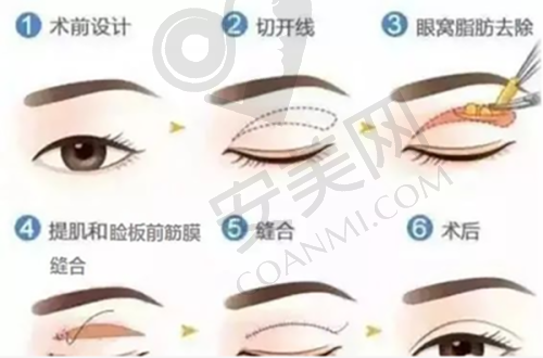 二、邯郸华景医院医疗美容科正规吗？
