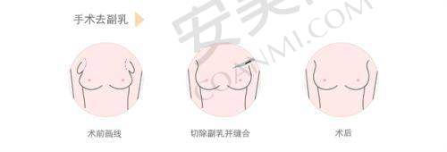 常州美贝尔医疗美容医院预约挂号流程：