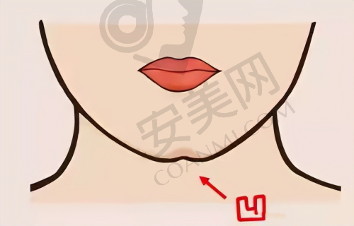 福州爱美尔整形医院疤痕修复医生技术怎么样？
