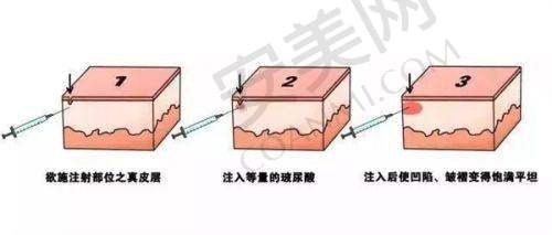 总结