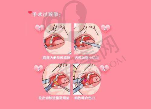 大连沙医生整形医院的技术设备精良吗？