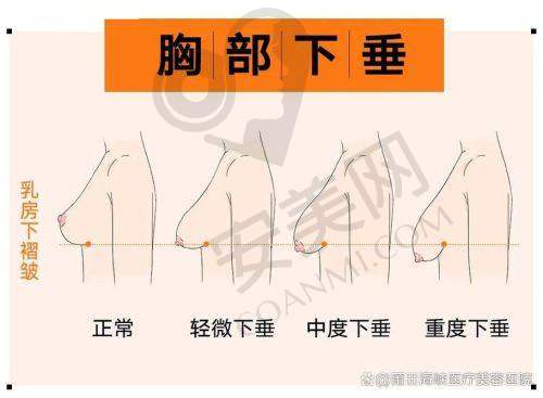 福州海峡医院真的能修复隆胸失败问题吗？