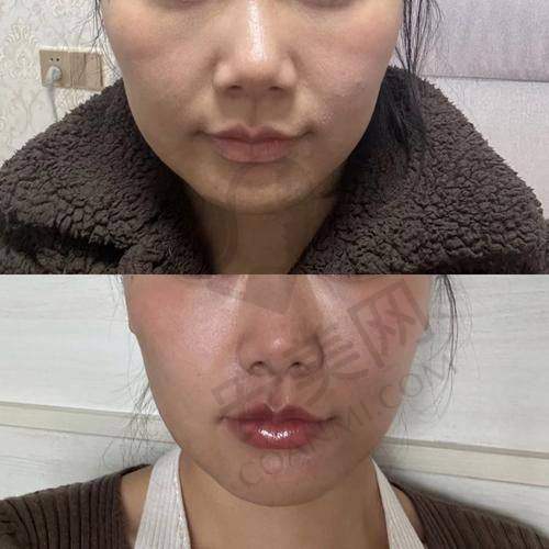 苏州紫馨陈云娟医生的优势在哪里？