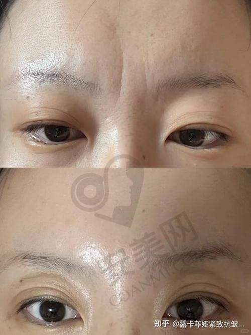 就诊前的询问与准备工作是怎样的？