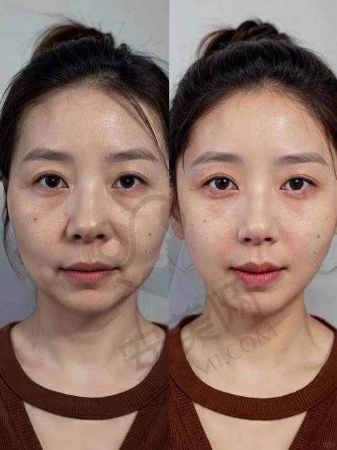 治疗过程是怎样的，感受如何？