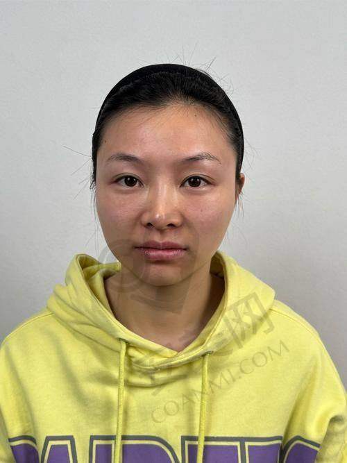 南昌佳美濡白天使填充的特色在哪里？