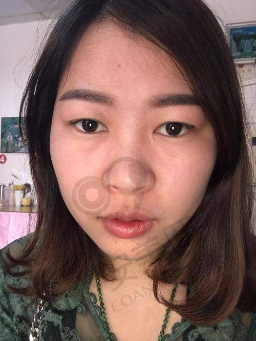 总结