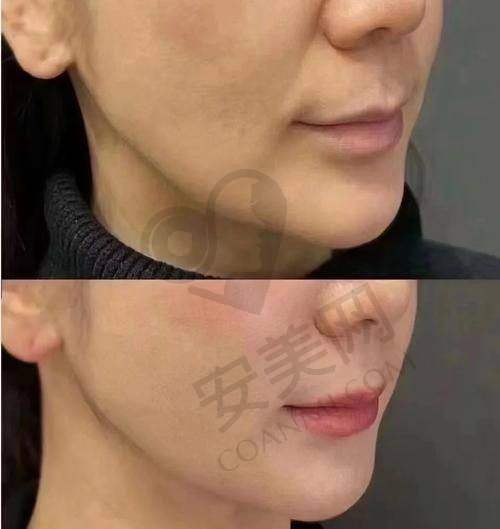 就诊过程是怎样的？