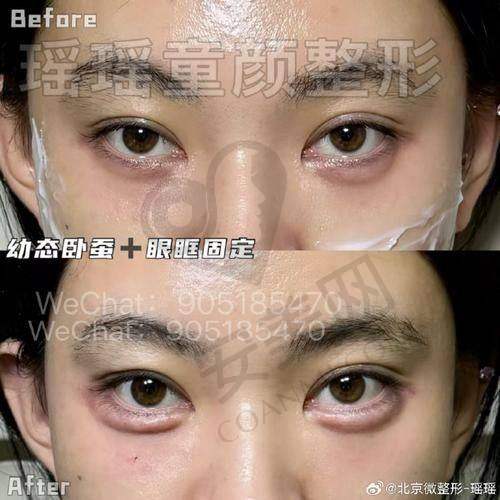 如何选择适合自己的整形医院