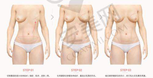重庆松山医院整形科收费标准背后的服务保护如何？