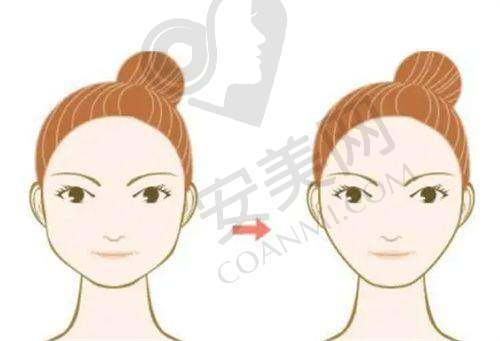 如何选择适合自己的北京碧莲盛医生？