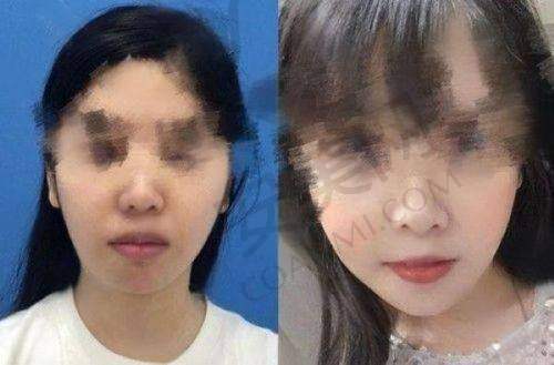 排名四：顿兆医生
