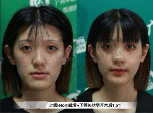 彭栋梁医生在患者中的口碑如何？