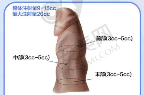 精良设备：科技助力整形治疗