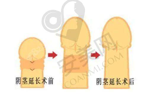 术后需要注意什么？