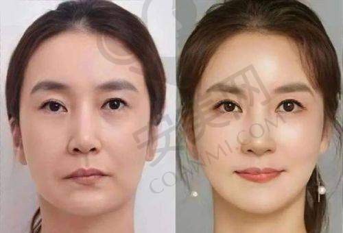 西安米兰柏羽医疗美容医院的技术设备精良吗？