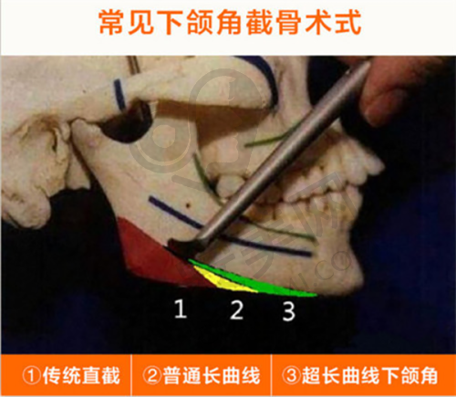 总结：值得信赖的整形选择