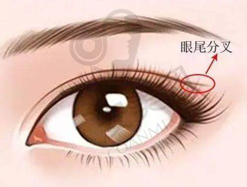 如何在长沙雅美获得更优惠的果酸换肤价格？
