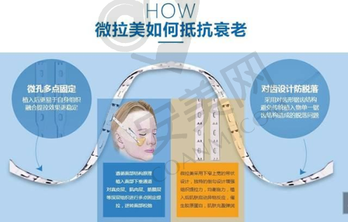 乌鲁木齐佳都俏臣李亚妮医生擅长项目