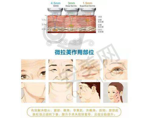 无锡施尔美医美：连锁品牌的可靠保护