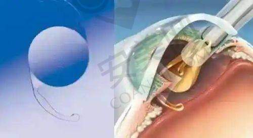 湛江韩美美容医院的安心性有保护吗？
