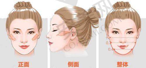 技术优势：多维度保护手术成效