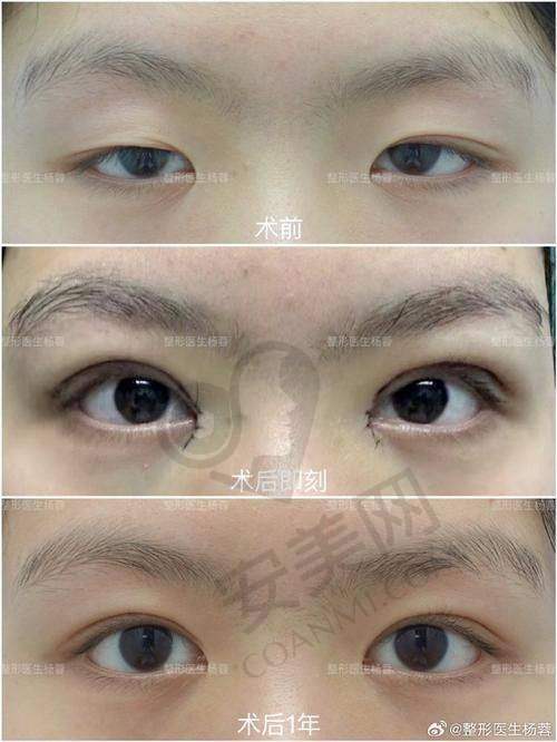 双华小鹿眼是什么？有何独特之处？