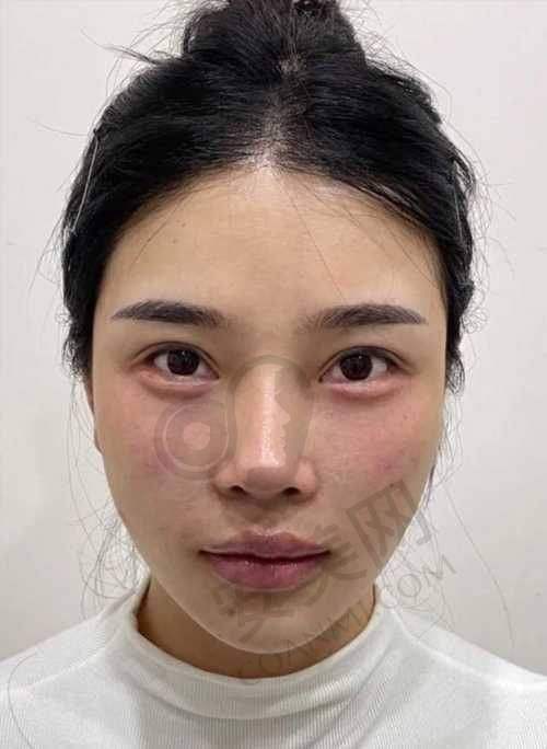 诊疗成效如何？