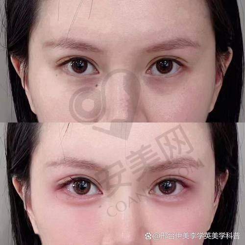 郑州王杨卧蚕修复项目有什么特色？